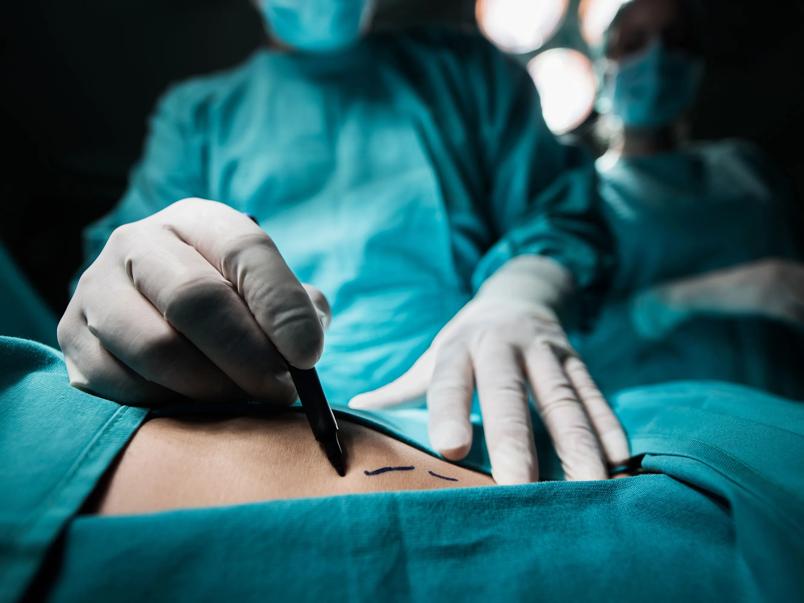 Brustvergrößerung mit Implantaten in NRW – Vertrauen Sie auf jahrelange Erfahrung